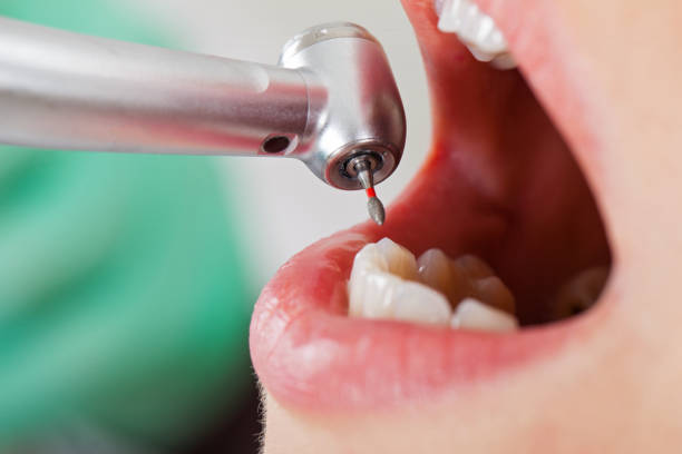 Best Emergency Treatment for Toothache in Waukon, IA